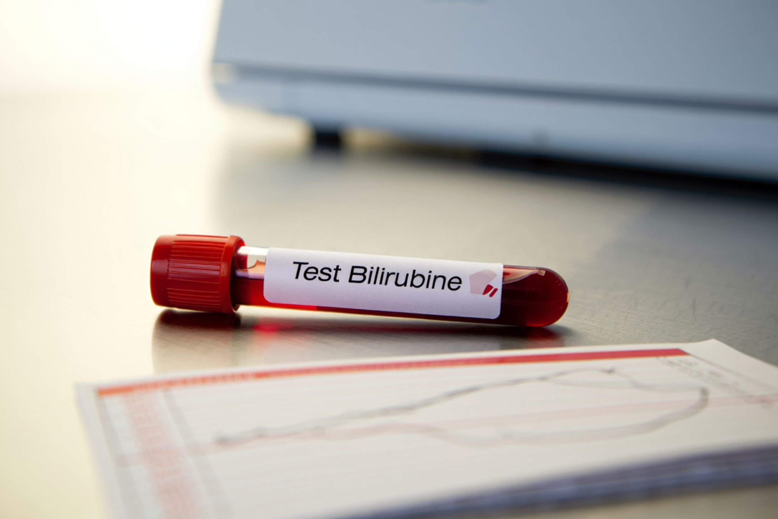 Prise de sang bilirubine